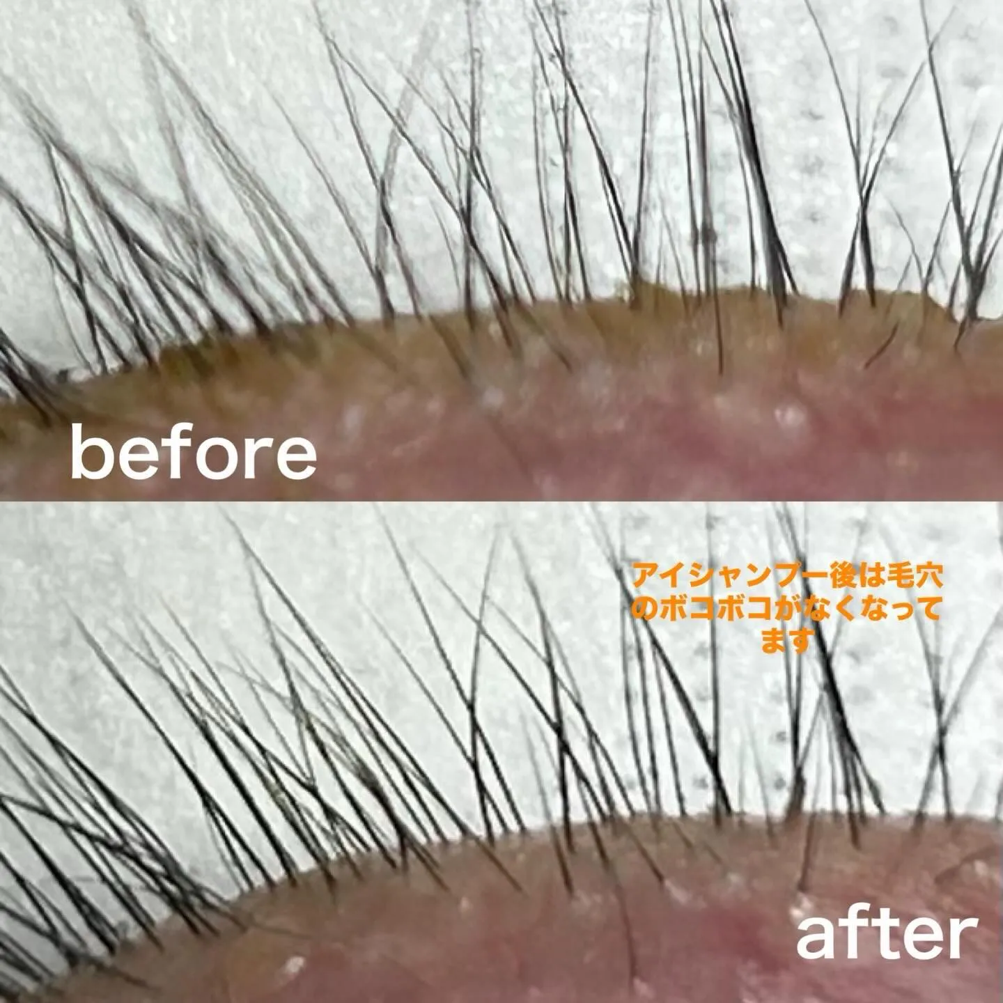✨️アイシャンプー✨️